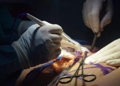 patient on operating table undergoing cospetic surgery